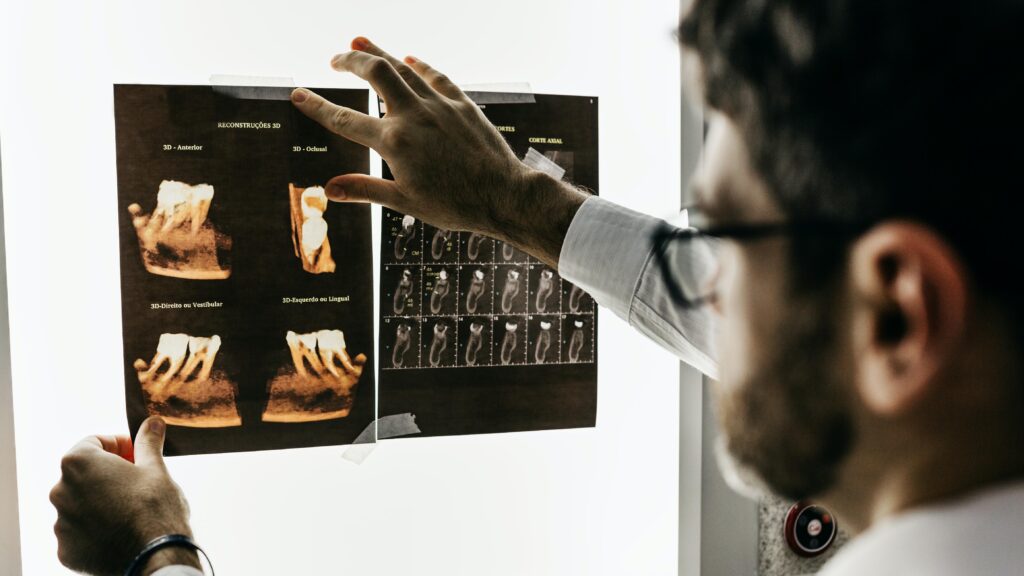 How Are TMJ Disorders Diagnosed?