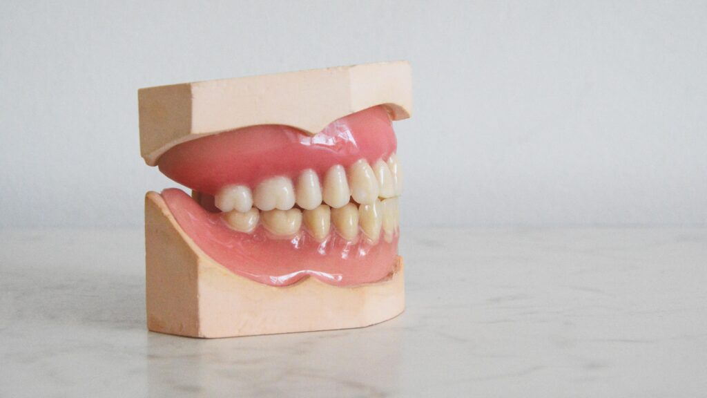 What You Need To Know Before Going For Composite Bonding Treatment