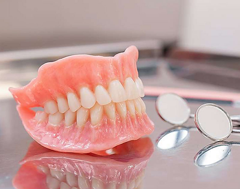 Full Arch Replacement