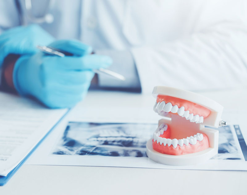 Multiple Tooth Replacement